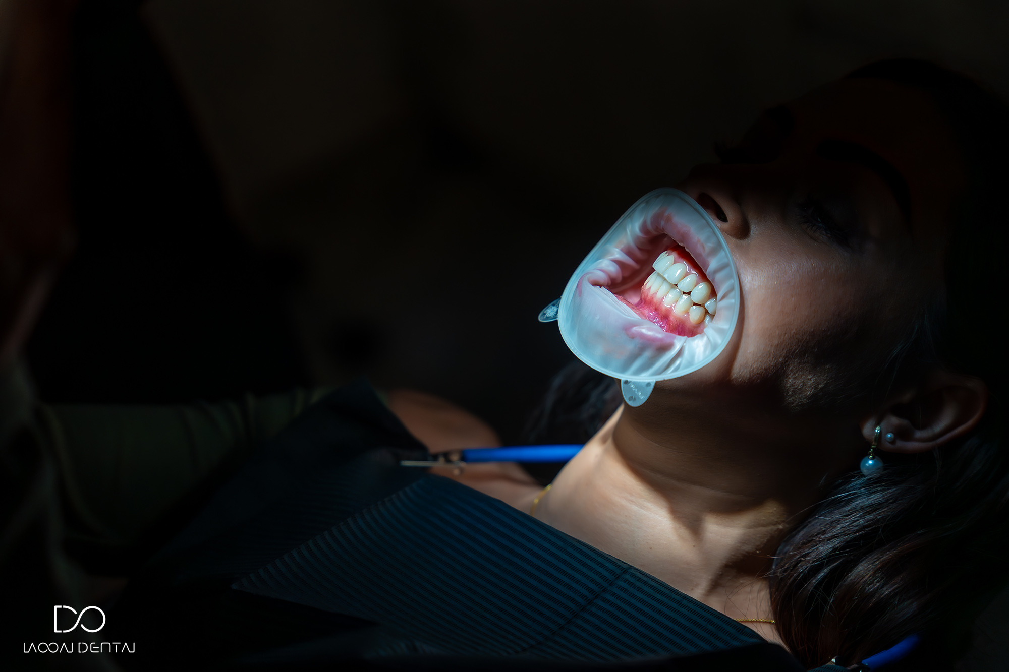 blanqueamiento dental en vecindario