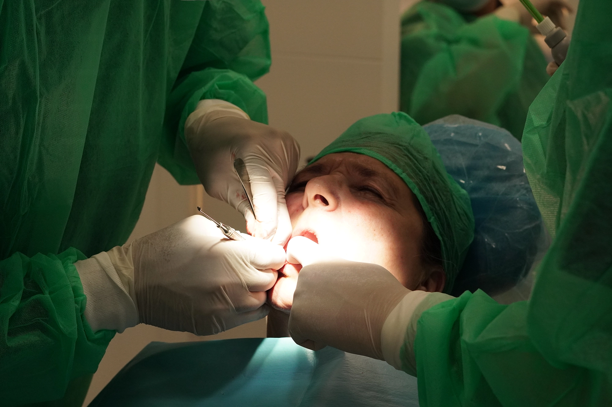 cirugia guiada en laooal dental