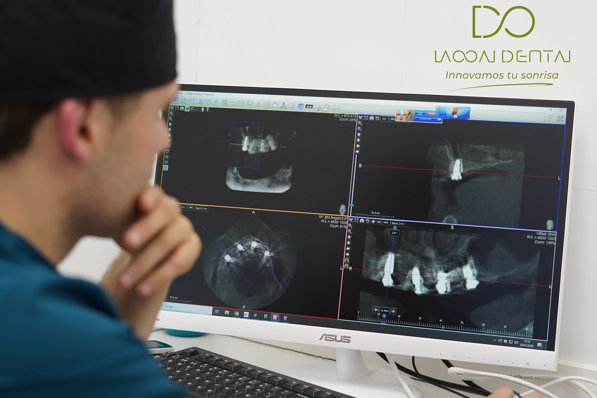 Método Da Vinci en Laooal Dental: cirugía guiada con planificación digital y máxima precisión